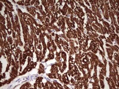 Immunohistochemistry: Troponin I Type 1 (slow skeletal) Antibody (OTI8H8) [NBP2-46170] - Analysis of Human adult heart tissue. Heat-induced epitope retrieval by 1 mM EDTA in 10 mM Tris, pH 8.5, 120C for 3 minutes.