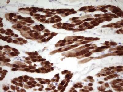 Immunohistochemistry: Troponin I Type 1 (slow skeletal) Antibody (OTI8H8) [NBP2-46170] - Analysis of Human muscle tissue. Heat-induced epitope retrieval by 1 mM EDTA in 10 mM Tris, pH 8.5, 120C for 3 minutes.