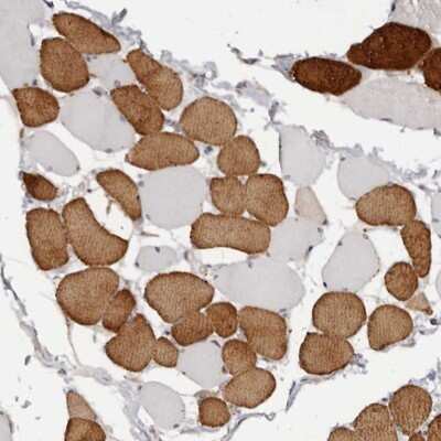 Immunohistochemistry-Paraffin: Troponin I Type 1 (slow skeletal) Antibody [NBP1-90923] - Staining of human skeletal muscle shows distinct cytoplasmic positivity in subsets of myocytes.