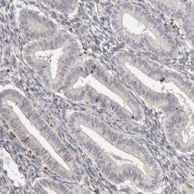 Immunohistochemistry-Paraffin: Troponin I Type 1 (slow skeletal) Antibody [NBP1-90923] - Staining of human Endometrium shows no cytoplasmic positivity in glandular cells as expected.