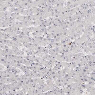 Immunohistochemistry-Paraffin: Troponin I Type 1 (slow skeletal) Antibody [NBP1-90923] - Staining of human Liver shows no cytoplasmic positivity in hepatocytes as expected.