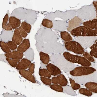 Immunohistochemistry-Paraffin: Troponin I Type 1 (slow skeletal) Antibody [NBP1-90923] - Staining of human Skeletal muscle shows strong cytoplasmic positivity in myocytes.