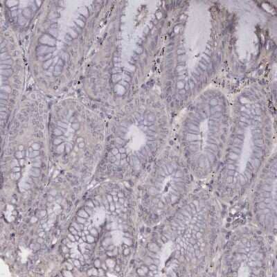 Immunohistochemistry-Paraffin: Troponin I Type 1 (slow skeletal) Antibody [NBP1-90923] - Staining of human Stomach shows no cytoplasmic positivity in glandular cells as expected.