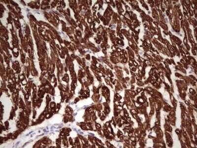 Immunohistochemistry: Troponin I Type 1 (slow skeletal) Antibody (OTI8H8) - Azide and BSA Free [NBP2-74639] - Analysis of Human adult heart tissue. (Heat-induced epitope retrieval by 1 mM EDTA in 10mM Tris, pH8.5, 120C for 3min)