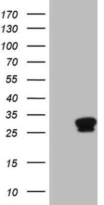 Western Blot: Troponin I Type 1 (slow skeletal) Antibody (OTI8H8) - Azide and BSA Free [NBP2-74639] - Analysis of HEK293T cells were transfected with the pCMV6-ENTRY control (Left lane) or pCMV6-ENTRY Troponin I Type 1.