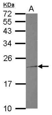 Western Blot: Troponin I Type 1 (slow skeletal) Antibody [NBP2-20733] - Sample (30 ug of whole cell lysate) A: Raji 12% SDS PAGE gel, diluted at 1:1000.