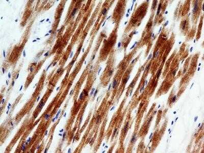 Immunocytochemistry: Troponin I Type 3 (cardiac) Antibody (1E10) - Azide and BSA Free [NBP2-80996] - IHC analysis of formalin-fixed paraffin-embedded tissue section of human heart using Troponin I antibody (clone 1E10) at 5 ug/ml concentration. The antibody specifically detected the target protein in cardiac muscle fibers in the tested sections, whereas,