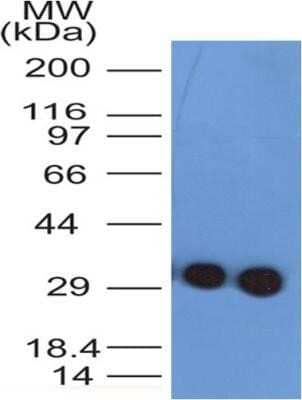 Western Blot: Troponin I Type 3 (cardiac) Antibody (1E10) - Azide and BSA Free [NBP2-80996] - Western blot analysis of clone 1E10 in human heart at 0.5 and 1.0 ug/ml. Image from the standard format of this antibody.