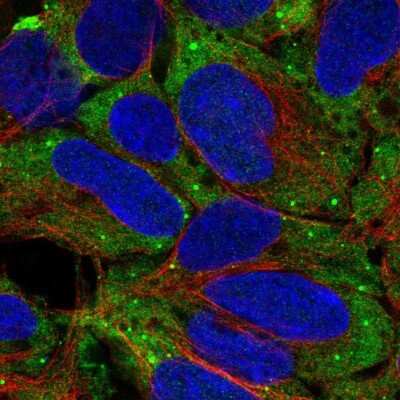 Immunocytochemistry/Immunofluorescence: Troponin I Type 3 (cardiac) Antibody [NBP2-33463] - Staining of human cell line HEK 293 shows localization to cytosol & vesicles.