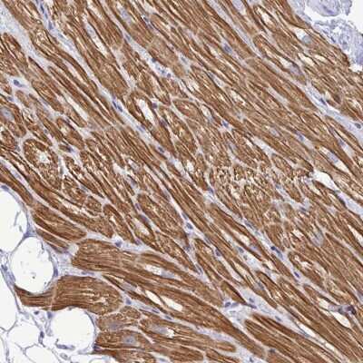 Immunohistochemistry: Troponin I Type 3 (cardiac) Antibody [NBP2-33463] - Staining of human heart muscle shows moderate cytoplasmic positivity in myocytes.