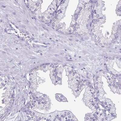 Immunohistochemistry-Paraffin: Troponin I Type 3 (cardiac) Antibody [NBP2-33463] - Staining of human prostate shows low expression as expected.