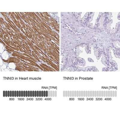 <b>Orthogonal Strategies Validation. </b>Immunohistochemistry-Paraffin: Troponin I Type 3 (cardiac) Antibody [NBP2-33463] - Staining in human heart muscle and prostate tissues using anti-TNNI3 antibody. Corresponding TNNI3 RNA-seq data are presented for the same tissues.