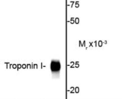 Western Blot: Troponin I Type 3 (cardiac) Antibody [NBP2-29658] - 20 ug of mouse heart lysate showing specific   immunolabeling of the ~25k cardiac troponin I protein.