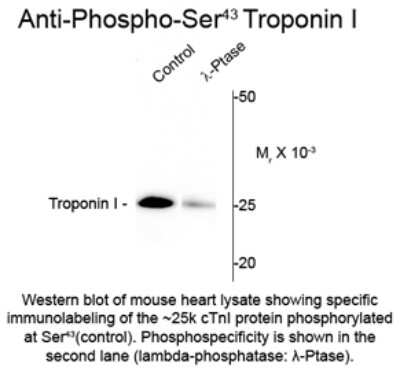 Western Blot: Troponin I Type 3 (cardiac) [p Ser43] Antibody [NBP2-29515] - Western blot of mouse heart lysate showing specific immunolabeling of the ~25k cTnI protein phosphorylated at Ser43 (control). Phosphospecificity is shown in the second lane. The blot is identical to the control except that the lysate was incubated in lambda-Ptase (1400 units for 30 min). The immunolabeling is greatly decreased by treatment with lambda-Ptase.