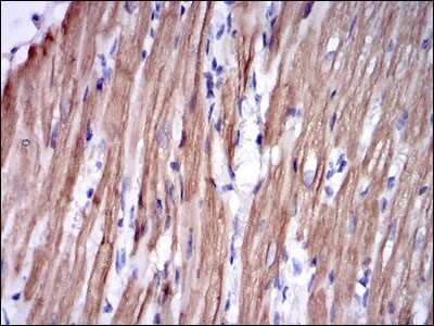 Immunohistochemistry: Troponin I type 2 (fast skeletal) Antibody (2F12A11) [NBP2-37551] - Immunohistochemical analysis of paraffin-embedded rabbit cardiac muscle tissues using TNNI2 mouse mAb with DAB staining.
