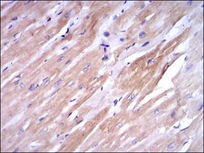 Immunohistochemistry: Troponin I type 2 (fast skeletal) Antibody (2F12A11) [NBP2-37551] - Immunohistochemical analysis of paraffin-embedded cardiac muscle tissues using TNNI2 mouse mAb with DAB staining.