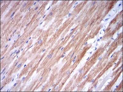 Immunohistochemistry: Troponin I type 2 (fast skeletal) Antibody (2F12A8) [NBP2-37549] - Immunohistochemical analysis of paraffin-embedded cardiac muscle tissues using TNNI2 mouse mAb with DAB staining.