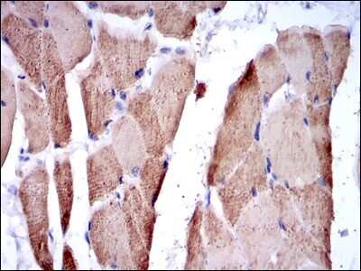 Immunohistochemistry: Troponin I type 2 (fast skeletal) Antibody (2F12A8) [NBP2-37549] - Immunohistochemical analysis of paraffin-embedded striated muscle tissues using TNNI2 mouse mAb with DAB staining.