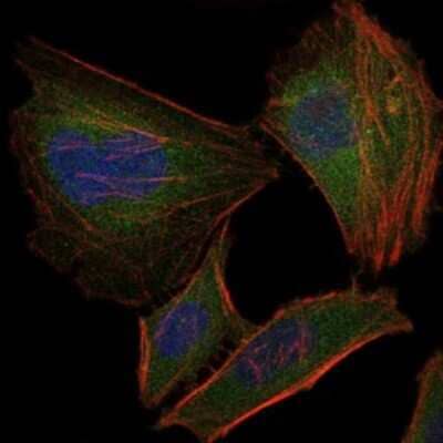 Immunocytochemistry/Immunofluorescence: Troponin I type 2 (fast skeletal) Antibody (2F12G2) [NBP2-37536] - Immunofluorescence analysis of Hela cells using TNNI2 mouse mAb (green). Blue: DRAQ5 fluorescent DNA dye. Red: Actin filaments have been labeled with Alexa Fluor-555 phalloidin.