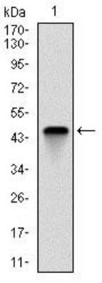 Western Blot: Troponin I type 2 (fast skeletal) Antibody (2F12G2) [NBP2-37536] - Western blot analysis using TNNI2 mAb against human TNNI2 (AA: 1-182) recombinant protein. (Expected MW is 21 kDa)