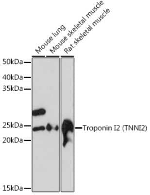 Western Blot: Troponin I type 2 (fast skeletal) Antibody (2H7S10) [NBP3-16474] - Western blot analysis of extracts of various cell lines, using Troponin I2 (Troponin I type 2 (fast skeletal)) Rabbit mAb (NBP3-16474) at 1:1000 dilution. Secondary antibody: HRP Goat Anti-Rabbit IgG (H+L) at 1:10000 dilution. Lysates/proteins: 25ug per lane. Blocking buffer: 3% nonfat dry milk in TBST. Detection: ECL Basic Kit. Exposure time: 30s.