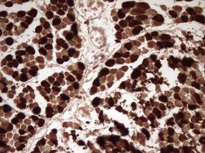 Immunohistochemistry: Troponin I type 2 (fast skeletal) Antibody (3A11) [NBP2-46171] - Analysis of Human muscle tissue. (Heat-induced epitope retrieval by 1 mM EDTA in 10mM Tris, pH8.5, 120C for 3min)