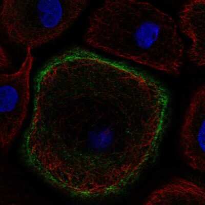 Immunocytochemistry/Immunofluorescence: Troponin I type 2 (fast skeletal) Antibody [NBP2-38775] - Staining of human cell line hTCEpi shows localization to plasma membrane. Antibody staining is shown in green.