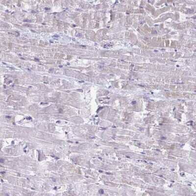 Immunohistochemistry-Paraffin: Troponin I type 2 (fast skeletal) Antibody [NBP2-38775] - Staining of human heart muscle shows low expression as expected.