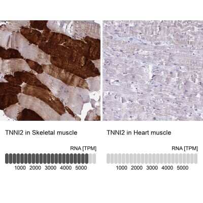 Immunohistochemistry-Paraffin: Troponin I type 2 (fast skeletal) Antibody [NBP2-38775] - Staining in human skeletal muscle and heart muscle tissues using anti-TNNI2 antibody. Corresponding TNNI2 RNA-seq data are presented for the same tissues.