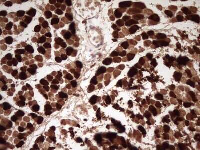 Immunohistochemistry: Troponin I type 2 (fast skeletal) Antibody (OTI3A11) - Azide and BSA Free [NBP2-74640] - Analysis of Human muscle tissue. (Heat-induced epitope retrieval by 1 mM EDTA in 10mM Tris, pH8.5, 120C for 3min)