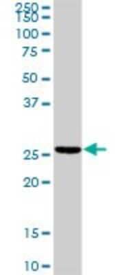 Western Blot: Troponin I type 2 (fast skeletal) Antibody [H00007136-D01P] - Analysis of TNNI2 expression in mouse spleen.
