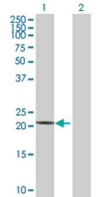 Western Blot: Troponin I type 2 (fast skeletal) Antibody [H00007136-D01P] - Analysis of TNNI2 expression in transfected 293T cell line by TNNI2 polyclonal antibody.Lane 1: TNNI2 transfected lysate(21.30 KDa).Lane 2: Non-transfected lysate.