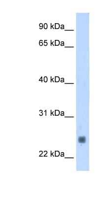 Western Blot: Troponin I type 2 (fast skeletal) Antibody [NBP1-57842] - Human Muscle lysate, concentration 1.25ug/ml.