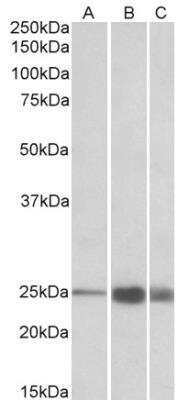 Western Blot: Troponin I type 2 (fast skeletal) Antibody [NBP2-26201] - Staining of Human (A), Mouse(B) and Rat (C) Skeletal Muscle lysate (35 ug protein in RIPA buffer). Primary incubation was 1 hour. Detected by chemiluminescence.  