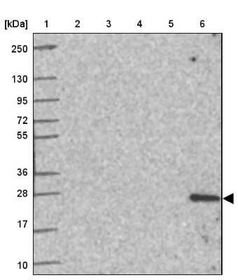 <b>Orthogonal Strategies Validation. </b>Western Blot: Troponin I type 2 (fast skeletal) Antibody [NBP2-38775] - Lane 1: Marker  [kDa] 250, 130, 95, 72, 55, 36, 28, 17, 10.  Lane 2: Human cell line RT-4.  Lane 3: Human cell line U-251MG.  Lane 4: Human Plasma.  Lane 5: Human liver tissue.  Lane 6: Human tonsil tissue