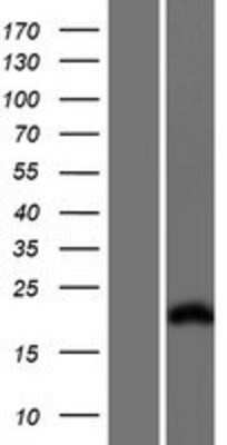 Western Blot: Troponin I type 2 (fast skeletal) Overexpression Lysate (Adult Normal) [NBP2-10871] Left-Empty vector transfected control cell lysate (HEK293 cell lysate); Right -Over-expression Lysate for Troponin I type 2 (fast skeletal).