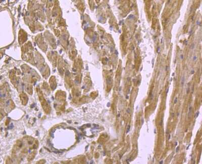 Immunohistochemistry-Paraffin: Troponin T Type 2 (cardiac) Antibody (3-G6) [NBP2-75430] - Analysis of mouse heart tissue using anti- Cardiac Troponin T antibody. Counter stained with hematoxylin.