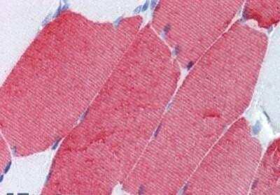 Immunohistochemistry-Paraffin: Troponin T Type 3 (fast skeletal) Antibody (T1/61) [NBP1-50604] - Analysis of anti-TNNT3 antibody with human skeletal muscle at concentration 10 ug/ml.