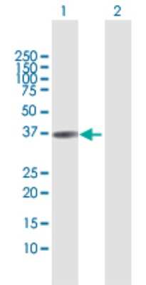 Western Blot: Troponin T type 1 (slow skeletal) Antibody [H00007138-D01P] - Analysis of TNNT1 expression in transfected 293T cell line by TNNT1 polyclonal antibody.Lane 1: TNNT1 transfected lysate(27.61 KDa).Lane 2: Non-transfected lysate.