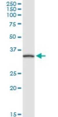 Western Blot: Troponin T type 1 (slow skeletal) Antibody [H00007138-D02P] - Analysis of TNNT1 expression in human placenta.