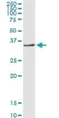 Western Blot: Troponin T type 1 (slow skeletal) Antibody [H00007138-D02P] - Analysis of TNNT1 expression in mouse kidney.