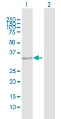 Western Blot: Troponin T type 1 (slow skeletal) Antibody [H00007138-D02P] - Analysis of TNNT1 expression in transfected 293T cell line by TNNT1 polyclonal antibody.Lane 1: TNNT1 transfected lysate(31.20 KDa).Lane 2: Non-transfected lysate.