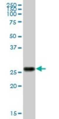 Western Blot: Trypsin 1/PRSS1 Antibody [H00005644-B01P] - Analysis of PRSS1 expression in human pancreas.