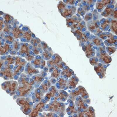 Immunohistochemistry-Paraffin: Trypsin 2/PRSS2 Antibody (3D9O7) [NBP3-15733] - Immunohistochemistry of paraffin-embedded rat pancreas using Trypsin 2/PRSS2 Rabbit mAb (NBP3-15733) at dilution of 1:100 (40x lens).Perform microwave antigen retrieval with 10 mM Tris/EDTA buffer pH 9.0 before commencing with IHC staining protocol.