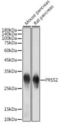 Western Blot: Trypsin 2/PRSS2 Antibody (3D9O7) [NBP3-15733] - Western blot analysis of extracts of various cell lines, using Trypsin 2/PRSS2 antibody (NBP3-15733) at 1:5000 dilution. Secondary antibody: HRP Goat Anti-Rabbit IgG (H+L) at 1:10000 dilution. Lysates/proteins: 25ug per lane. Blocking buffer: 3% nonfat dry milk in TBST. Detection: ECL Basic Kit. Exposure time: 1s.