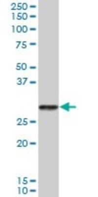 Western Blot: Trypsin 2/PRSS2 Antibody [H00005645-B01P] - Analysis of PRSS2 expression in human pancreas.