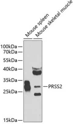 Western Blot: Trypsin 2/PRSS2 Antibody [NBP2-93609] - Analysis of extracts of various cell lines, using Trypsin 2/PRSS2 at 1:1000 dilution. Secondary antibody: HRP Goat Anti-Rabbit IgG (H+L) at 1:10000 dilution. Lysates/proteins: 25ug per lane. Blocking buffer: 3% nonfat dry milk in TBST. Detection: ECL Basic Kit . Exposure time: 90s.