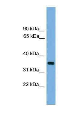 Western Blot: Trypsin 3/PRSS3 Antibody [NBP1-57036] - Human Muscle lysate, concentration 0.2-1 ug/ml.