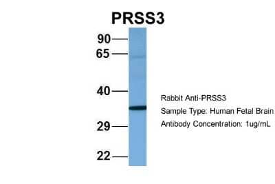 Western Blot: Trypsin 3/PRSS3 Antibody [NBP1-57036] - Human Fetal Brain, Antibody Dilution: 1.0 ug/ml.