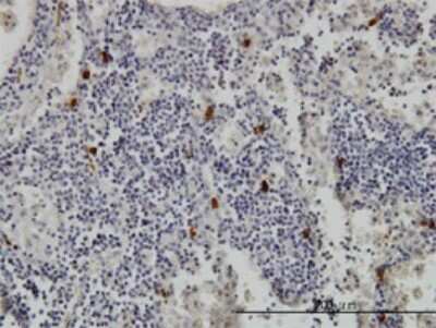 Immunohistochemistry-Paraffin: Tryptase alpha/TPS1 Antibody (2A10-B5) [H00007177-M01] - Analysis of monoclonal antibody to TPSAB1 on formalin-fixed paraffin-embedded human lymph node. Antibody concentration 1 ug/ml.